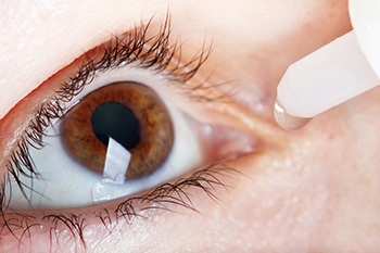 Ocular Surface Disease